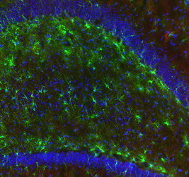 海馬迴星狀膠細胞螢光染色